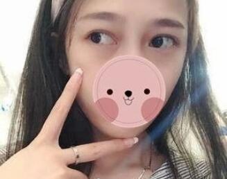 为您揭秘超声波去眼袋126 为您揭秘超声波去眼袋126