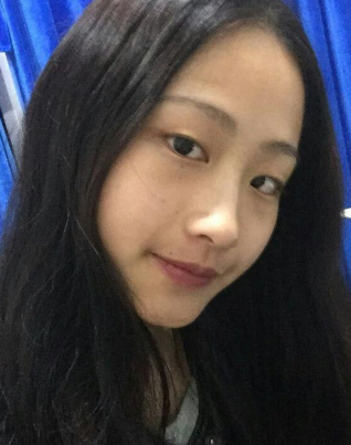 超声波双眼皮手术让我做最好看的自己209 超声波双眼皮手术让我做最好看的自己209