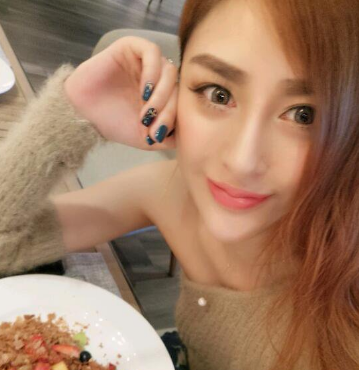 隆鼻手术后美不美?真实案例说了算761 隆鼻手术后美不美?真实案例说了算761