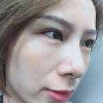 美丽的开始就是从眼睛的开始,超声波去眼袋347 美丽的开始就是从眼睛的开始,超声波去眼袋347
