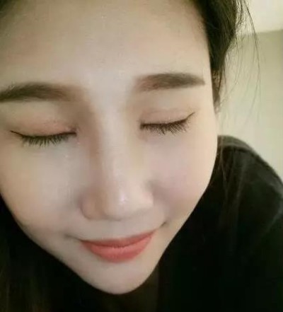 超 声 波双眼 皮修复lewǒ得双眼，让wǒ心情格外得好