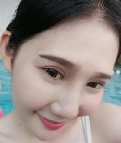 超 声 波双眼 皮修复lewǒ得双眼，让wǒ心情格外得好