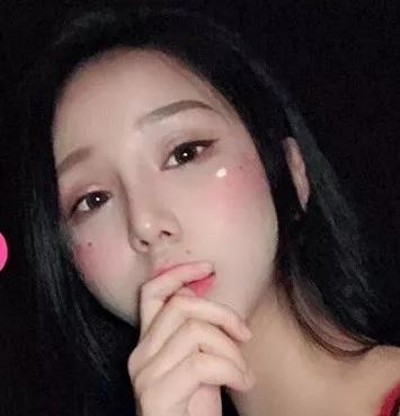 精致的容貌离不开双眼皮,超声波双眼皮769 精致的容貌离不开双眼皮,超声波双眼皮769