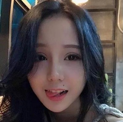 精致的容貌离不开双眼皮,超声波双眼皮769 精致的容貌离不开双眼皮,超声波双眼皮769