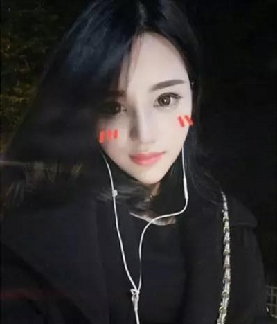 有了双眼皮每天自信满满,超声波双眼皮977 有了双眼皮每天自信满满,超声波双眼皮977