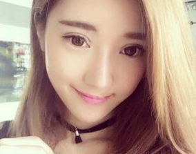 那个做过超声波双眼皮手术的女孩，现在怎么样了？035