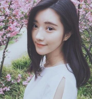 那个做过超声波双眼皮手术的女孩，现在怎么样了？035