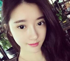 那个做过超声波双眼皮手术的女孩，现在怎么样了？035