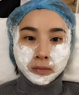 重庆超雅面部提升术让颓废大嫂晋级氧气美女634 重庆超雅面部提升术让颓废大嫂晋级氧气美女634