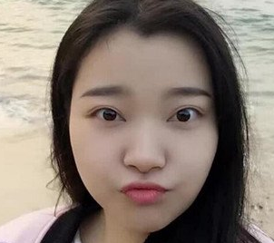 想完美的拥有颜值,重庆超雅帮你实现483 想完美的拥有颜值,重庆超雅帮你实现483