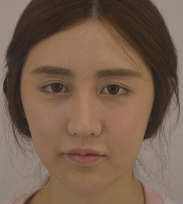 想完美的拥有颜值,重庆超雅帮你实现483 想完美的拥有颜值,重庆超雅帮你实现483