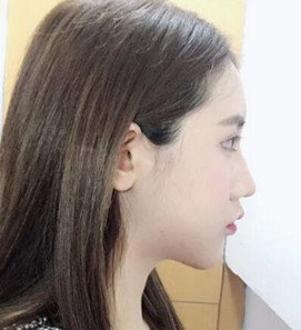 想完美的拥有颜值,重庆超雅帮你实现483 想完美的拥有颜值,重庆超雅帮你实现483