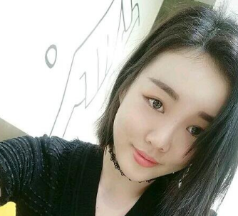 重庆超雅自体脂肪填充术让你拥有少女该有的容颜502