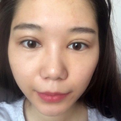 去掉眼袋拥有完美的妆容,超声波去眼袋167 去掉眼袋拥有完美的妆容,超声波去眼袋167