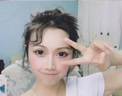 做了超声波双眼皮,一副永久的双眼皮601 做了超声波双眼皮,一副永久的双眼皮601