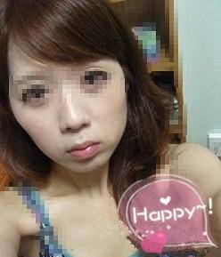 超雅不开刀隆鼻手术塑造挺翘鼻型 超雅不开刀隆鼻手术塑造挺翘鼻型