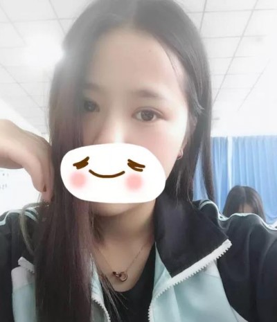 怎样做双眼皮才不会痛？超声波双眼皮，无痛的双眼皮787