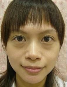 想去眼袋就现在超 声 波去眼袋把 想去眼袋就现在超 声 波去眼袋把