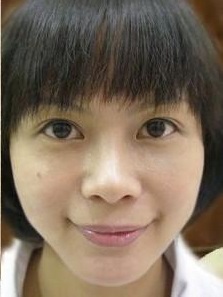 想去眼袋就现在超 声 波去眼袋把 想去眼袋就现在超 声 波去眼袋把