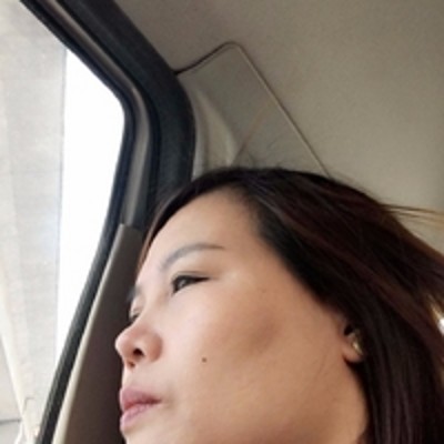 成功得去掉le眼袋,超 声 波去眼袋。 成功得去掉le眼袋,超 声 波去眼袋。