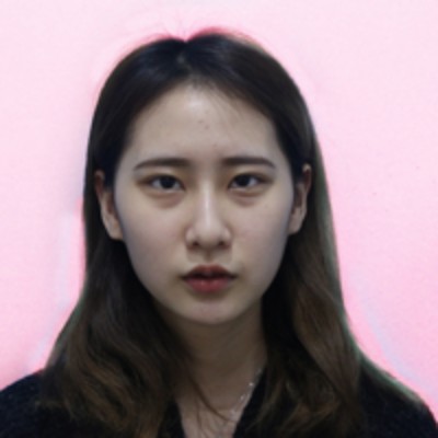 去掉眼袋重获美丽,超声波去眼袋。660 去掉眼袋重获美丽,超声波去眼袋。660