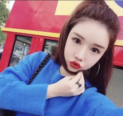 很自然,很漂亮得双眼皮,超声波双眼皮978 很自然,很漂亮得双眼皮,超声波双眼皮978