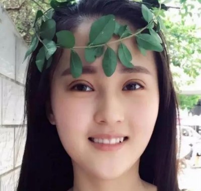 怎么做双眼皮最安全?超声波双眼皮。658 怎么做双眼皮最安全?超声波双眼皮。658