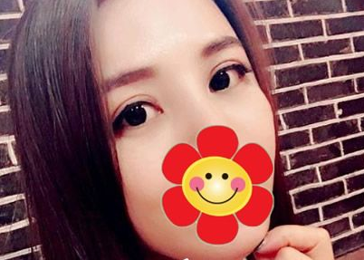 看到wǒ做le超 声 波去眼袋,同事后悔le 看到wǒ做le超 声 波去眼袋,同事后悔le