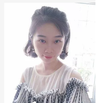 超 声 波去眼袋手术,原来效果这么好 超 声 波去眼袋手术,原来效果这么好