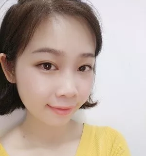 超 声 波去眼袋手术,原来效果这么好 超 声 波去眼袋手术,原来效果这么好