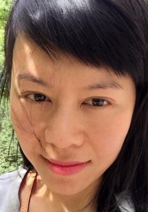 重庆超雅面部提升术让我向着青春逆向生长183 重庆超雅面部提升术让我向着青春逆向生长183