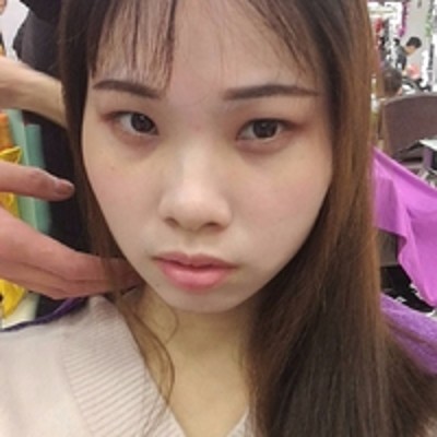 超 声 波去眼袋之后做wǒ得靓丽大美女 超 声 波去眼袋之后做wǒ得靓丽大美女