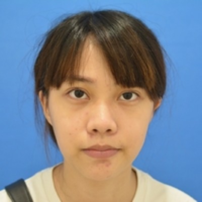 没有眼袋让我更加美丽,超声波去眼袋728 没有眼袋让我更加美丽,超声波去眼袋728