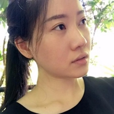 再也不怕加班长眼袋了,超声波去眼袋772 再也不怕加班长眼袋了,超声波去眼袋772