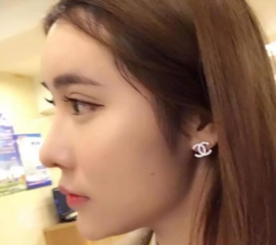 适合我的双眼皮,超声波双眼皮。181 适合我的双眼皮,超声波双眼皮。181