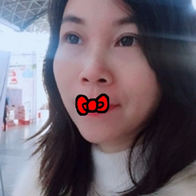 超 声 波去眼袋让你留住美好! 超 声 波去眼袋让你留住美好!