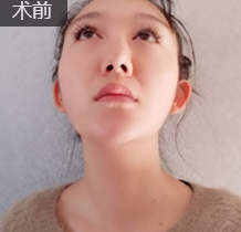 新晋直播榜首女神,只做了隆鼻手术就美炸天!640 新晋直播榜首女神,只做了隆鼻手术就美炸天!640