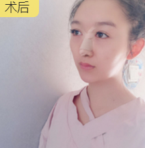 新晋直播榜首女神,只做了隆鼻手术就美炸天!640 新晋直播榜首女神,只做了隆鼻手术就美炸天!640