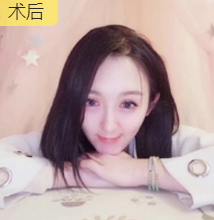 新晋直播榜首女神,只做了隆鼻手术就美炸天!640 新晋直播榜首女神,只做了隆鼻手术就美炸天!640