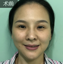 重庆超雅超级微拉美,果然可以扫除衰老问题862 重庆超雅超级微拉美,果然可以扫除衰老问题862