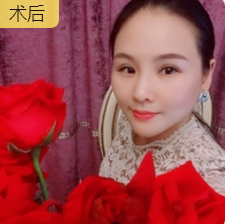 重庆超雅超级微拉美,果然可以扫除衰老问题862 重庆超雅超级微拉美,果然可以扫除衰老问题862