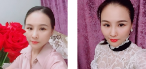 重庆超雅超级微拉美,果然可以扫除衰老问题862 重庆超雅超级微拉美,果然可以扫除衰老问题862