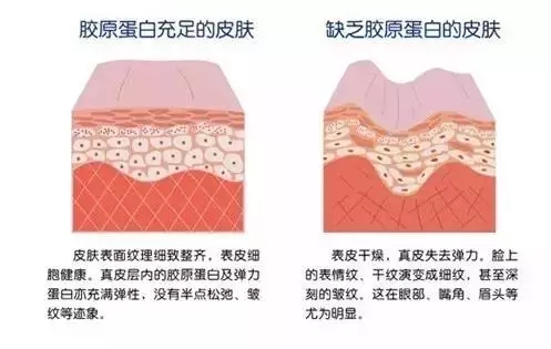 重庆超级微拉美手术好在哪里 重庆超级微拉美手术好在哪里