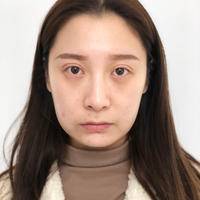 重庆超级微拉美手术好在哪里 重庆超级微拉美手术好在哪里