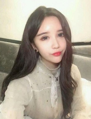 幸福来得太突然，超声波去眼袋手术终究根治了眼袋！953