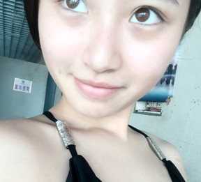 小姐姐心酸战眼袋4年，如今终于用超声波去眼袋得偿所愿！923