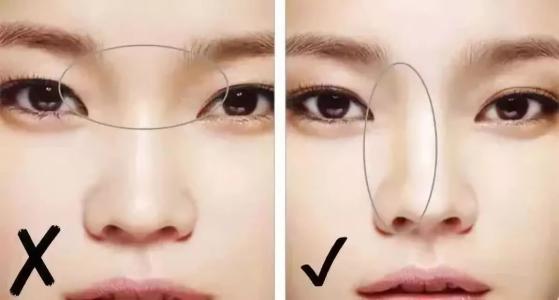 单眼 皮眼距过宽怎么办，有超雅超 声 波双眼 皮和开眼角手术啊