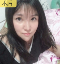 重庆超雅得超级微拉美,逆龄有效! 重庆超雅得超级微拉美,逆龄有效!