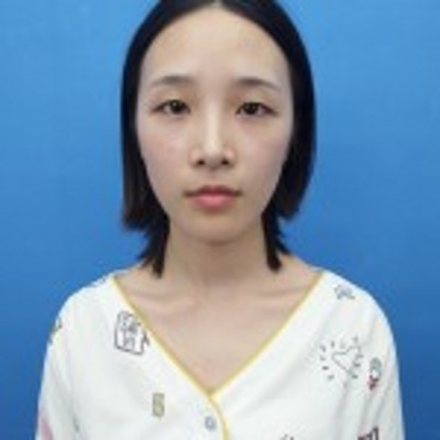 超 声 波双眼 皮,给wǒleー双明眸 超 声 波双眼 皮,给wǒleー双明眸