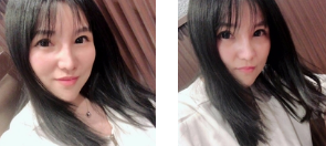 贪心年轻不再shì梦——面部提升术 贪心年轻不再shì梦——面部提升术